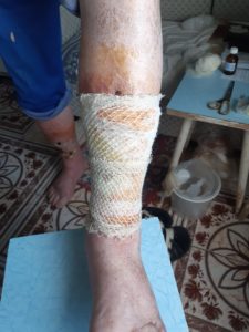Сосудистый хирург в Ростове - на - Дону - Жолковский Александр Владимирович