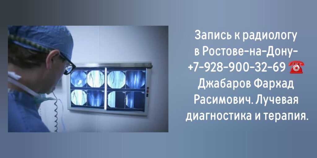 Джабаров Фархад Расимович- врач радиолог Ростов