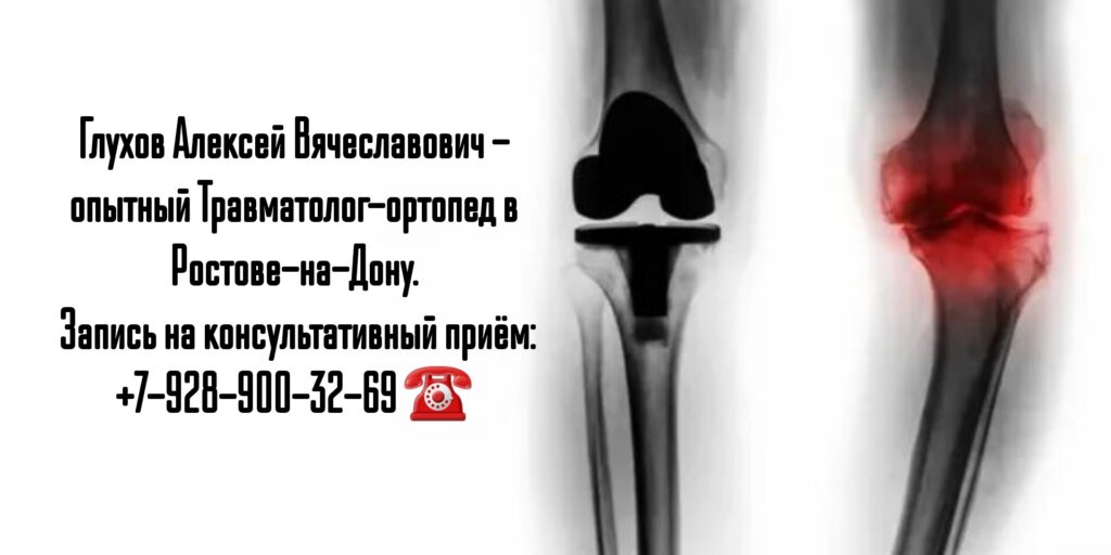 Глухов Алексей Вячеславович - замена сустава в Ростове-на-Дону 