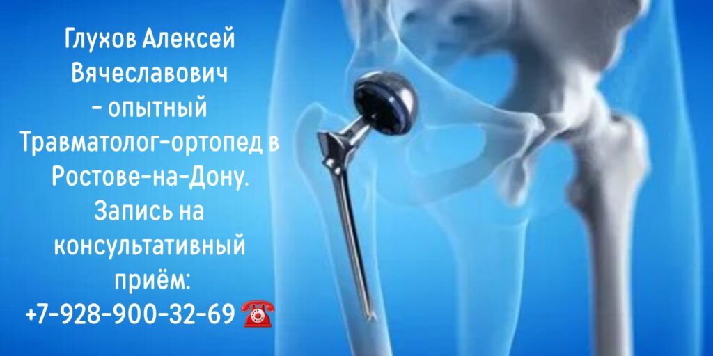 Глухов Алексей Вячеславович - замена сустава в Ростове-на-Дону 