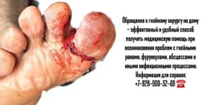 Вызов на дом гнойного хирурга в Ростове-на-Дону 