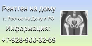 Ростов-на-Дону Рентген на дому: комфорт и удобство диагностики