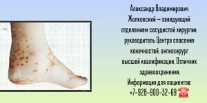 Опытный сосудистый хирург Ростов-на-Дону - Жолковский Александр Владимирович 