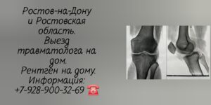 Ростов Вызов травматолога на дом - рентген на дому