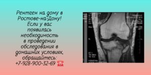 Диагностика Рентген на дому Ростов-на-Дону