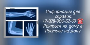Врач на дом Ростов-на-Дону рентген 