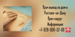 Ростов как вызвать на дом хирурга? Снять швы на дому