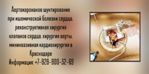 Кардиохирург в Краснодаре - Болдырев Сергей Юрьевич 