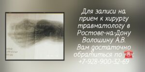 Выдаюшийся ортопед - травматолог в Ростове-на-Дону - Волошин Андрей Викторович