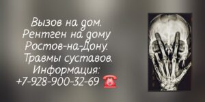 Рентген - вызов на дом Ростов-на-Дону - травмы суставов  