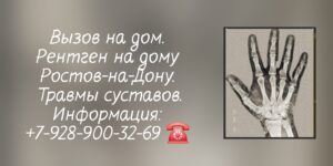 Рентген - вызов на дом Ростов-на-Дону - травмы суставов  