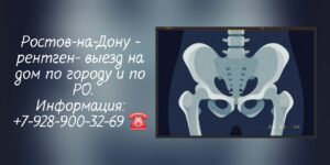 Рентген на дом - Ростов-на-Дону 