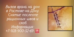 Снятие скоб и швов после операции в Ростове-на-Дону