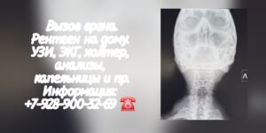 Рентген на дому Ростов-на-Дону Батайск Аксай