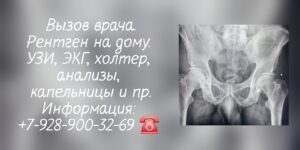 Рентген на дому Ростов-на-Дону Батайск Аксай