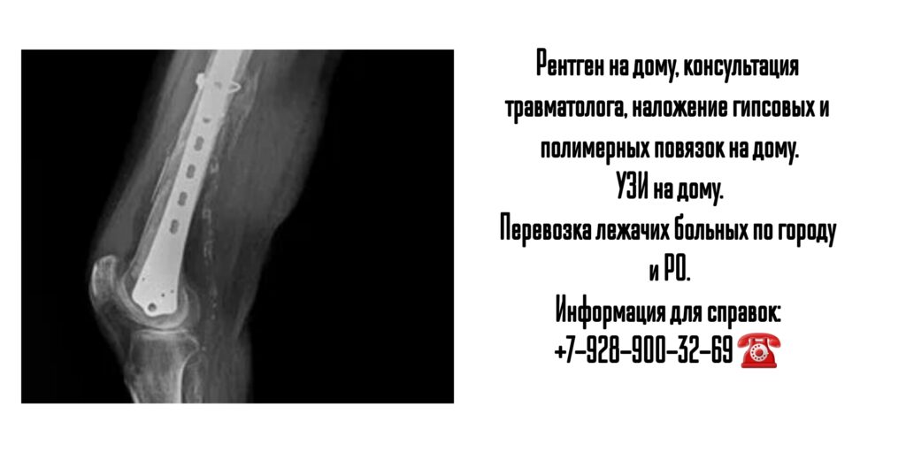 Рентген и УЗИ на дому в Ростове-на-Дону