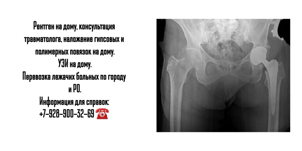 Рентген и УЗИ на дому в Ростове-на-Дону