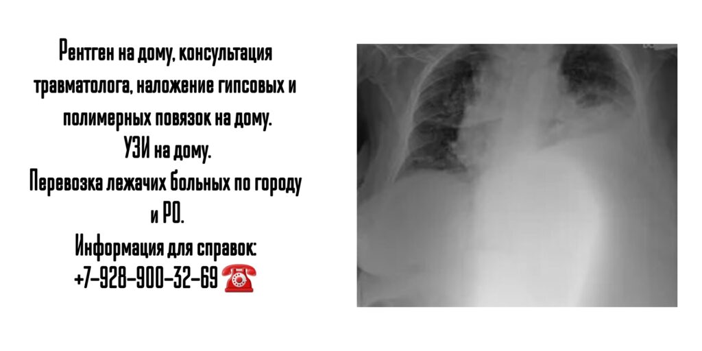 Рентген и УЗИ на дому в Ростове-на-Дону