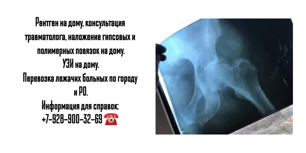Рентген и УЗИ на дому в Ростове-на-Дону