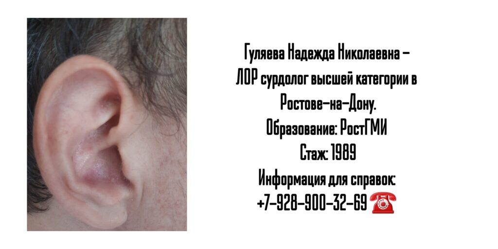 Хороший ЛОР в Ростове-на-Дону - Гуляева Надежда Николаевна