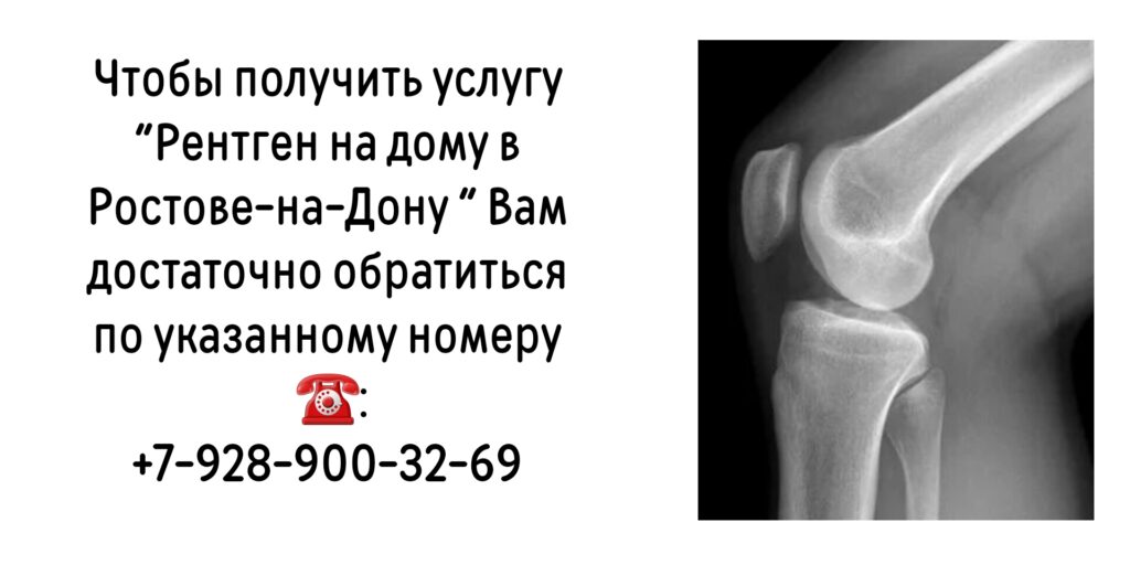 Как сделать Рентген на дому в Ростове-на-Дону?