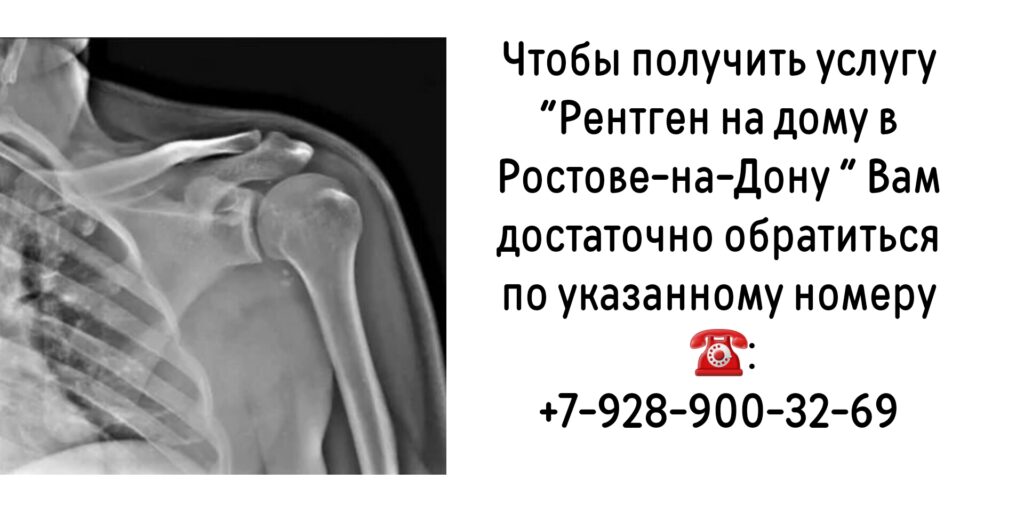 Как сделать Рентген на дому в Ростове-на-Дону?