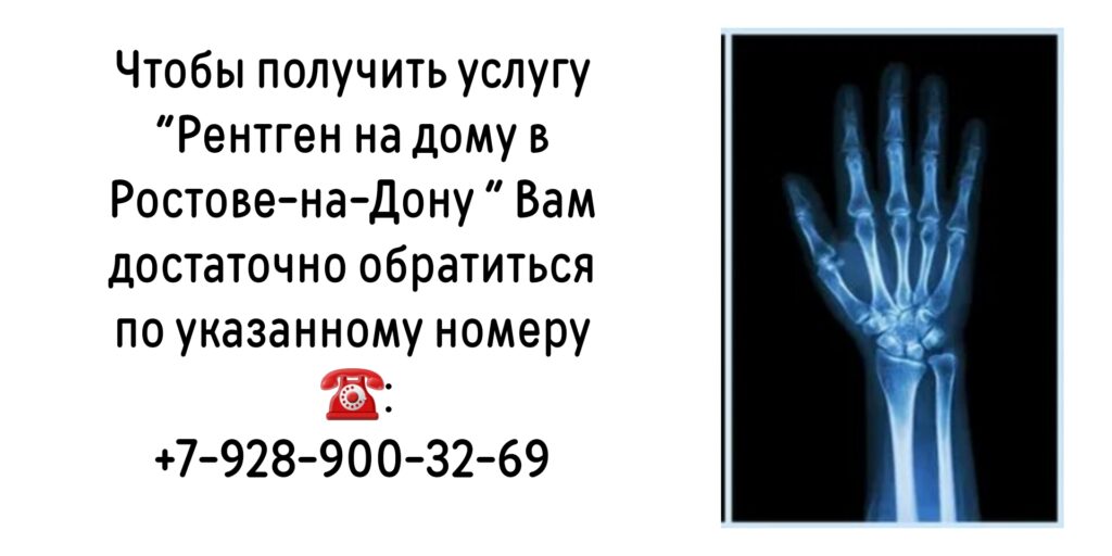 Как сделать Рентген на дому в Ростове-на-Дону?