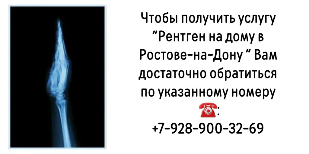 Как сделать Рентген на дому в Ростове-на-Дону?