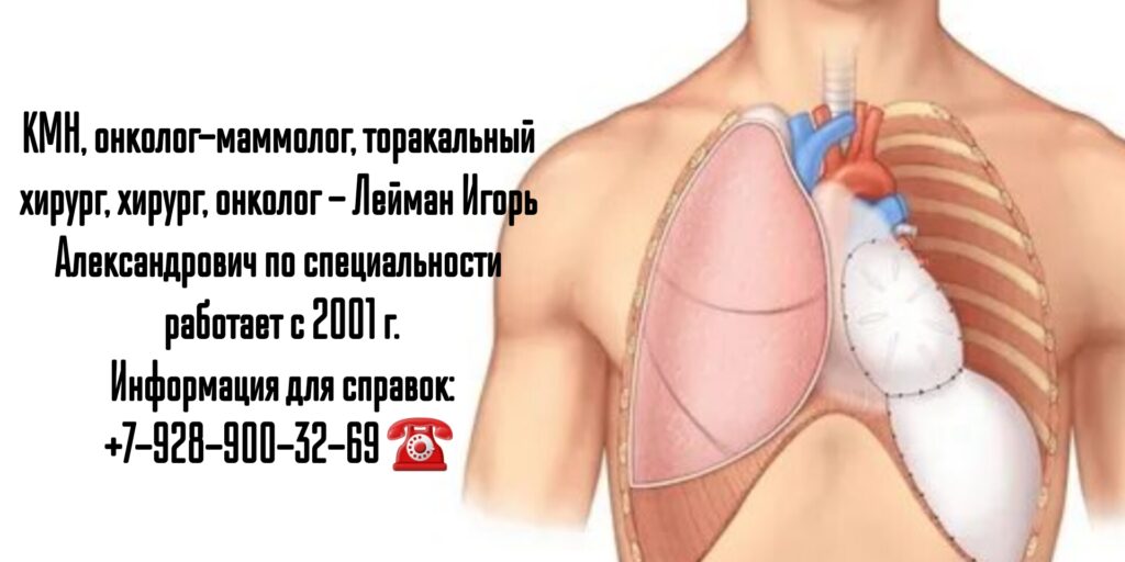 Рак легких - лечение в Ростове-на-Дону- Лейман Игорь Александрович 
