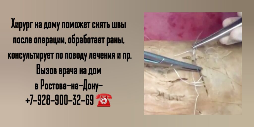 Хирург на дом Ростов - вызов врача