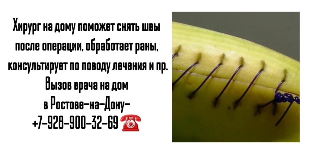 Хирург на дом Ростов - вызов врача