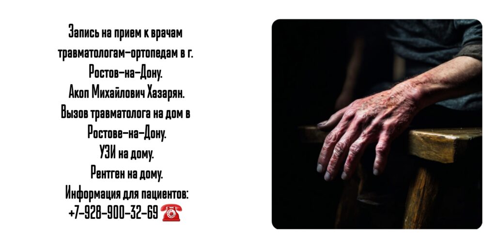 Кистевой хирург в Ростове операции на кисти - Акоп Михайлович Хазарян