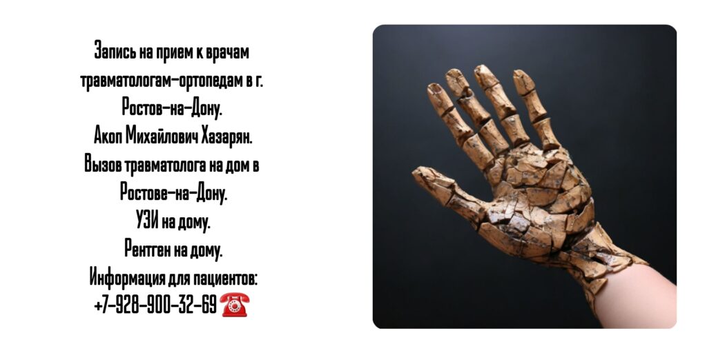 Кистевой хирург в Ростове операции на кисти - Акоп Михайлович Хазарян
