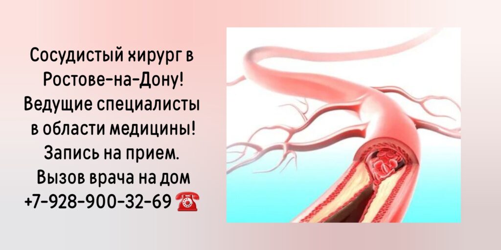 Жолковский Александр Владимирович - Запись на прием к сосудистому хирургу в Ростове-на-Дону 