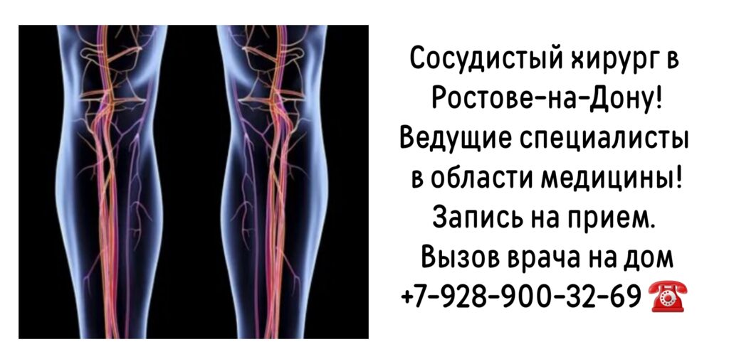 Жолковский Александр Владимирович - Запись на прием к сосудистому хирургу в Ростове-на-Дону 