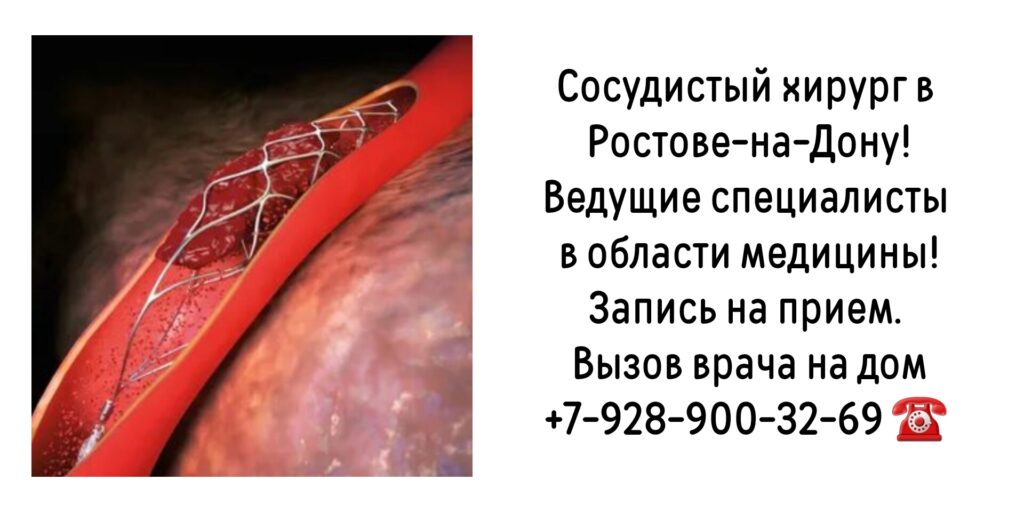 Жолковский Александр Владимирович - Запись на прием к сосудистому хирургу в Ростове-на-Дону 