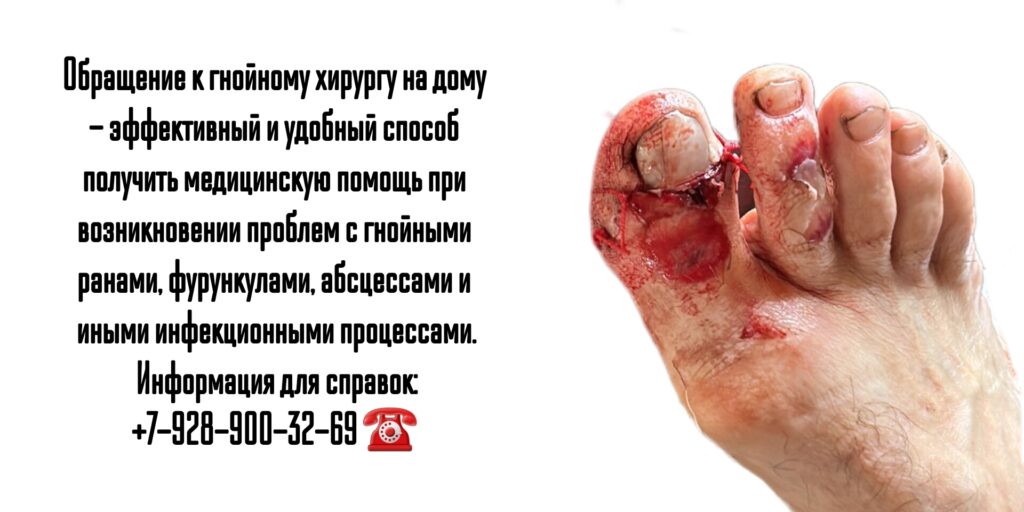 Вызов на дом гнойного хирурга в Ростове-на-Дону 