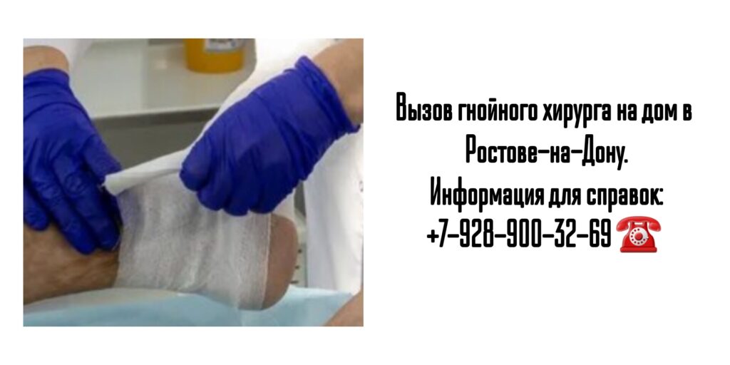 Вызов на дом гнойного хирурга в Ростове-на-Дону 