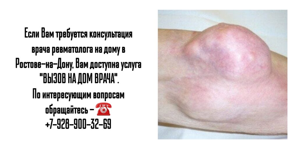 Как вызвать ревматолога на дому в Ростове-на-Дону?