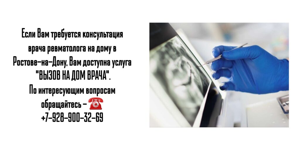 Как вызвать ревматолога на дому в Ростове-на-Дону?