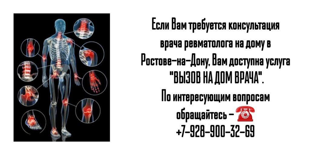 Как вызвать ревматолога на дому в Ростове-на-Дону?