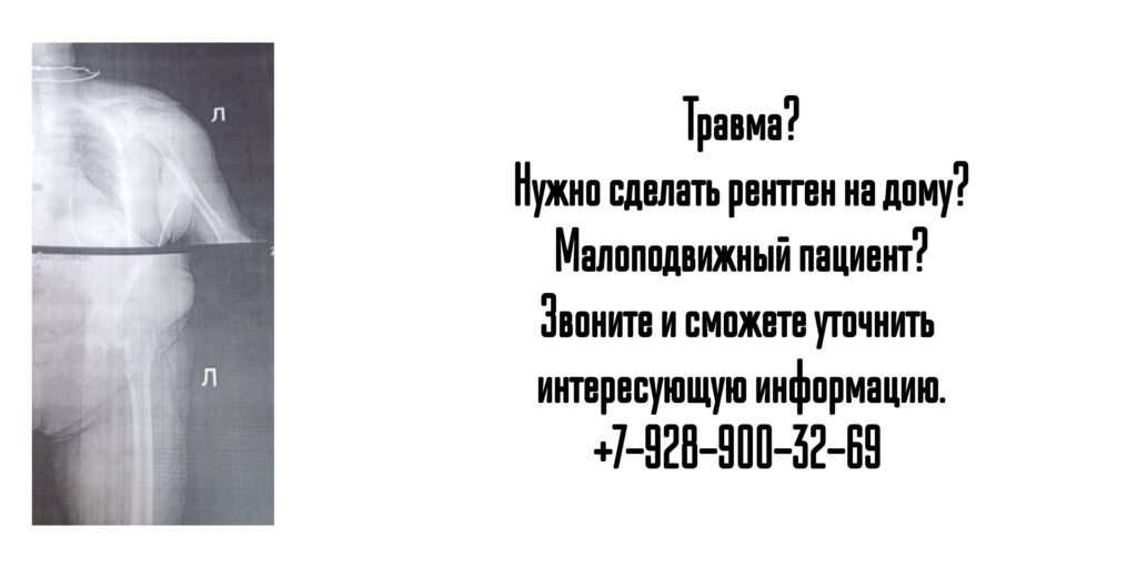 Ростов - сделать рентген на дому