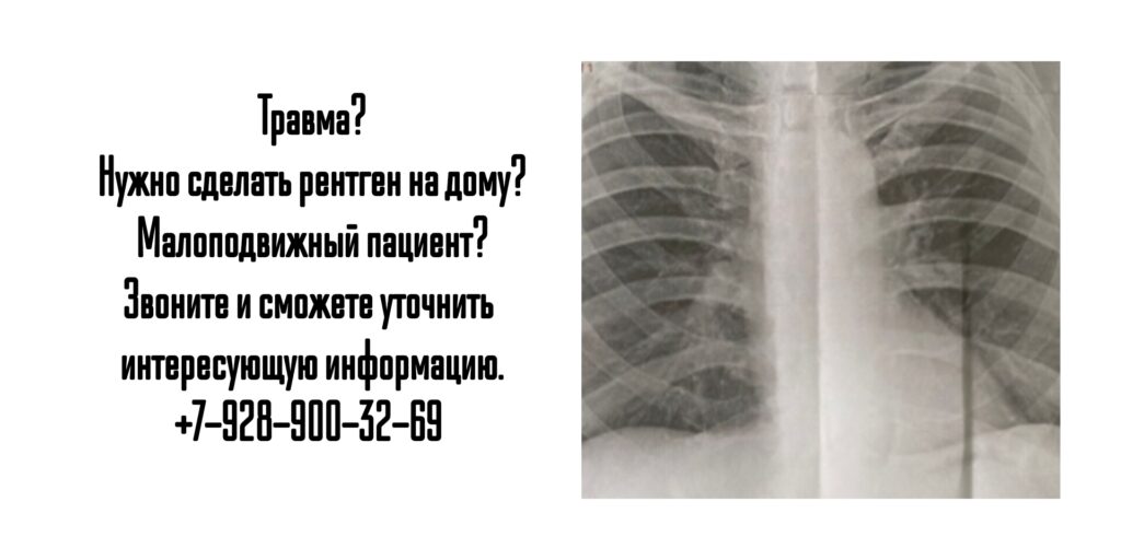 Ростов - сделать рентген на дому