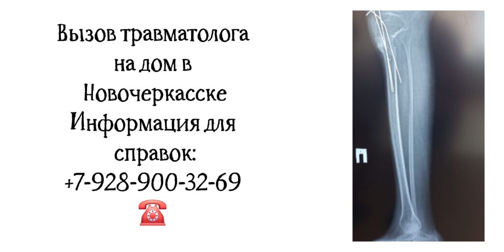 Грамотный травматолог в Новочеркасске