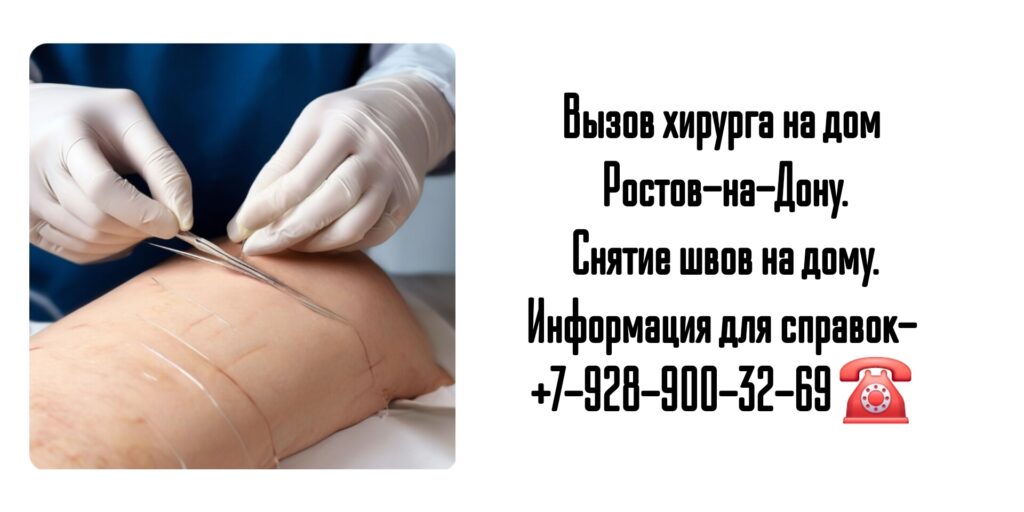 Ростов снятие швов на дому после операции