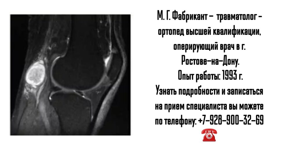 Фабрикант М. Г. - консультация травматолога-ортопеда в Ростове-на-Дону 