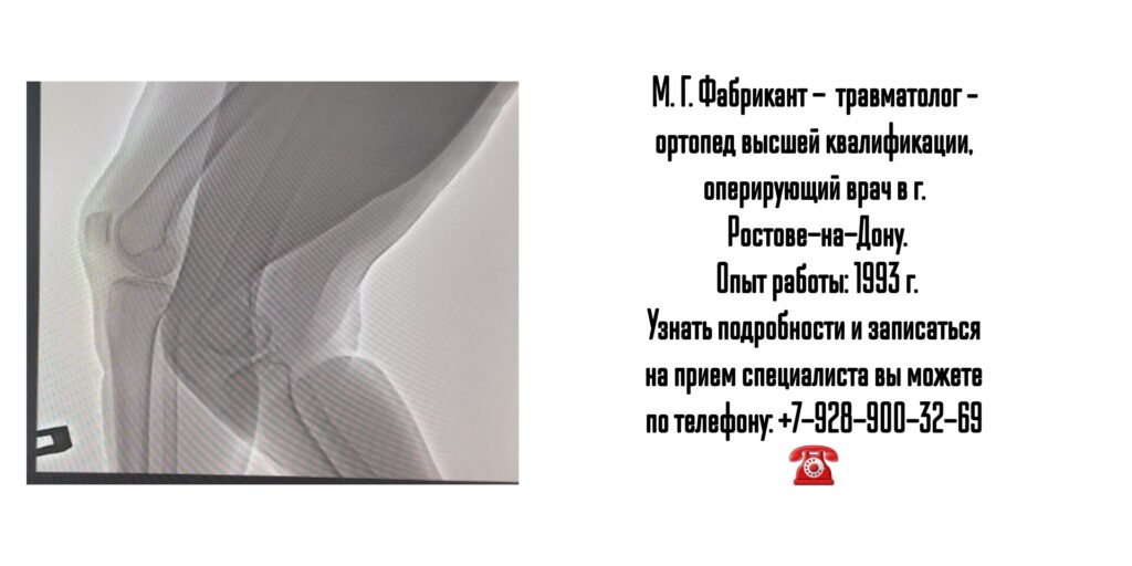 Фабрикант М. Г. - консультация травматолога-ортопеда в Ростове-на-Дону 