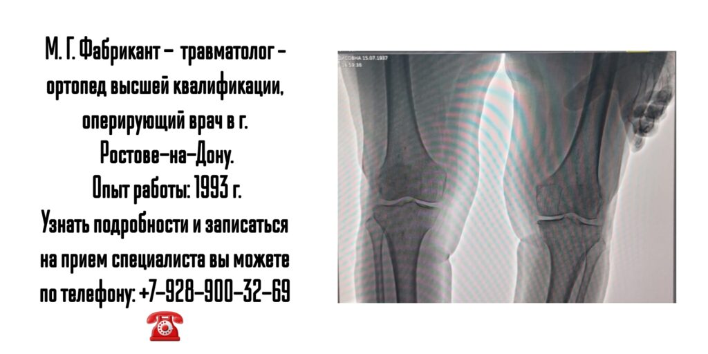 Фабрикант М. Г. - консультация травматолога-ортопеда в Ростове-на-Дону 