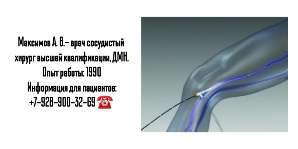 Максимов Александр Владимирович - сосудистый хирург - Казань