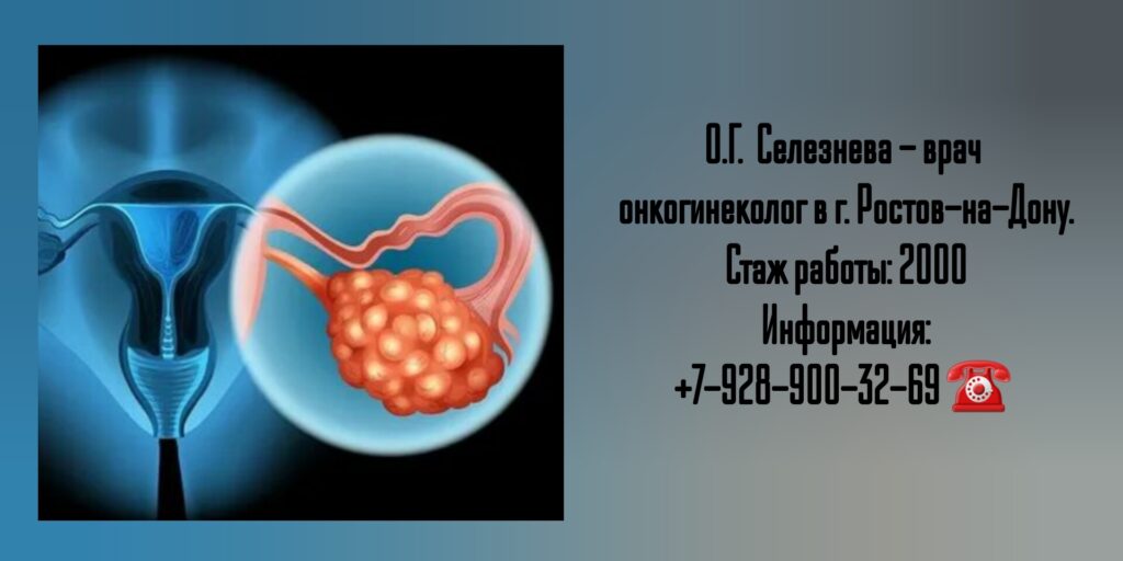 Селезнева О Г - врач онкогинеколог в Ростове-на-Дону
